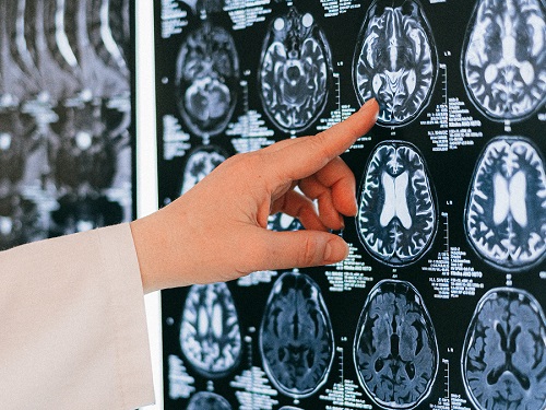 Tech News : Musk’s Brain Chips Ready For Humans